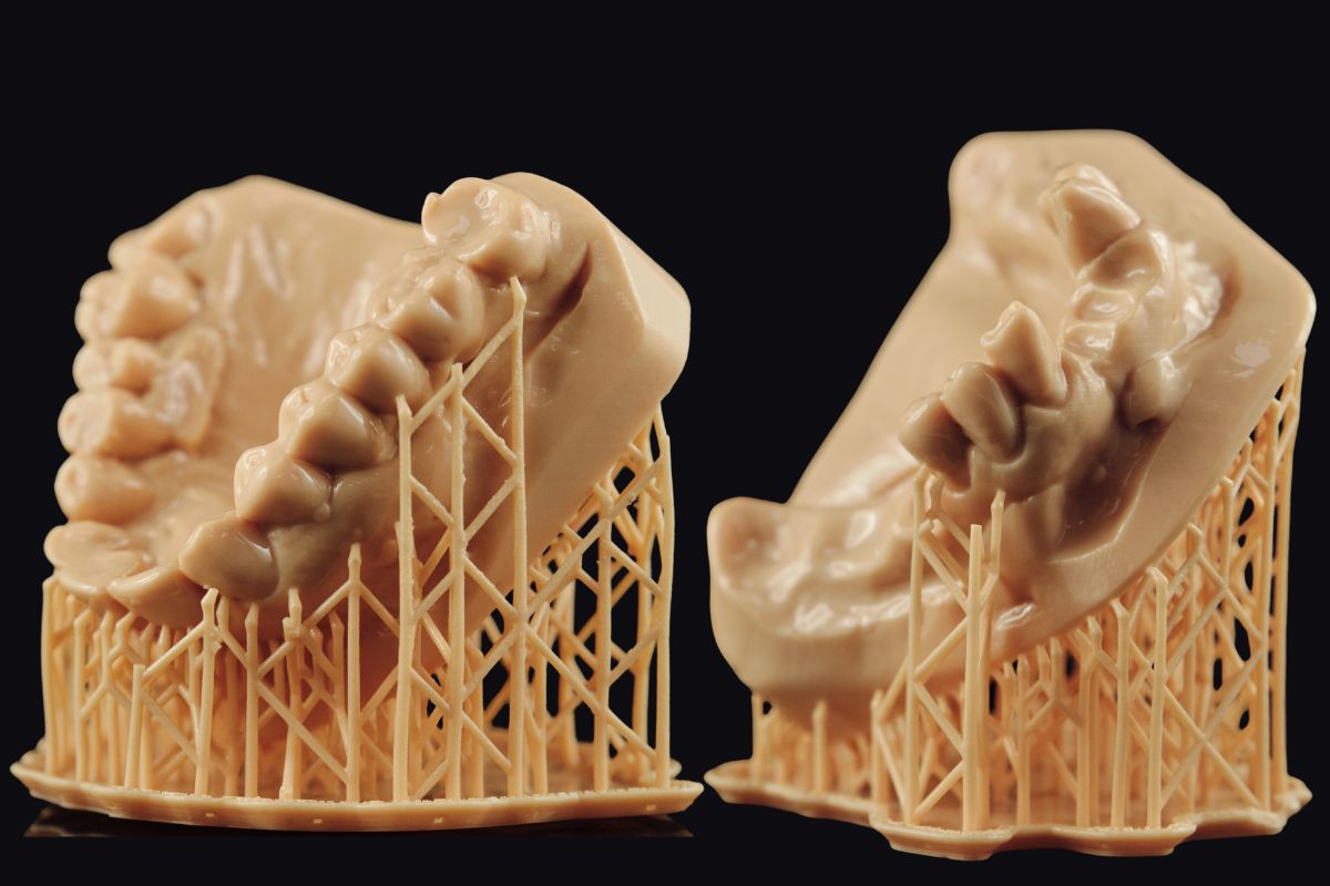 3D printed orthodontic models created from digital scans, showing the precision used in appliance design