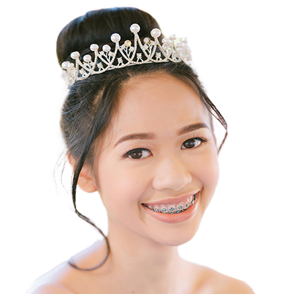 Teenage girls with metal braces smiling dressed to go out