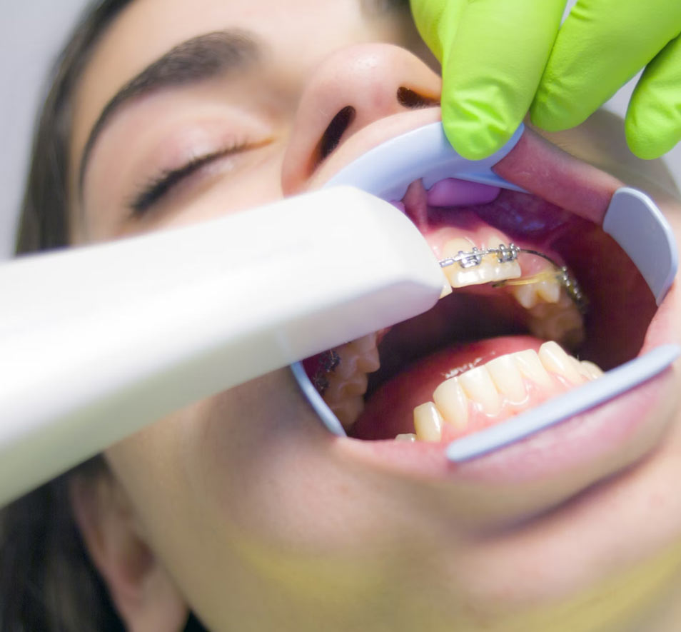 Patient having their teeth scanned during an orthodontic appointment