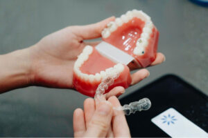 Clear Aligners: Understanding How They Work and What to Expect