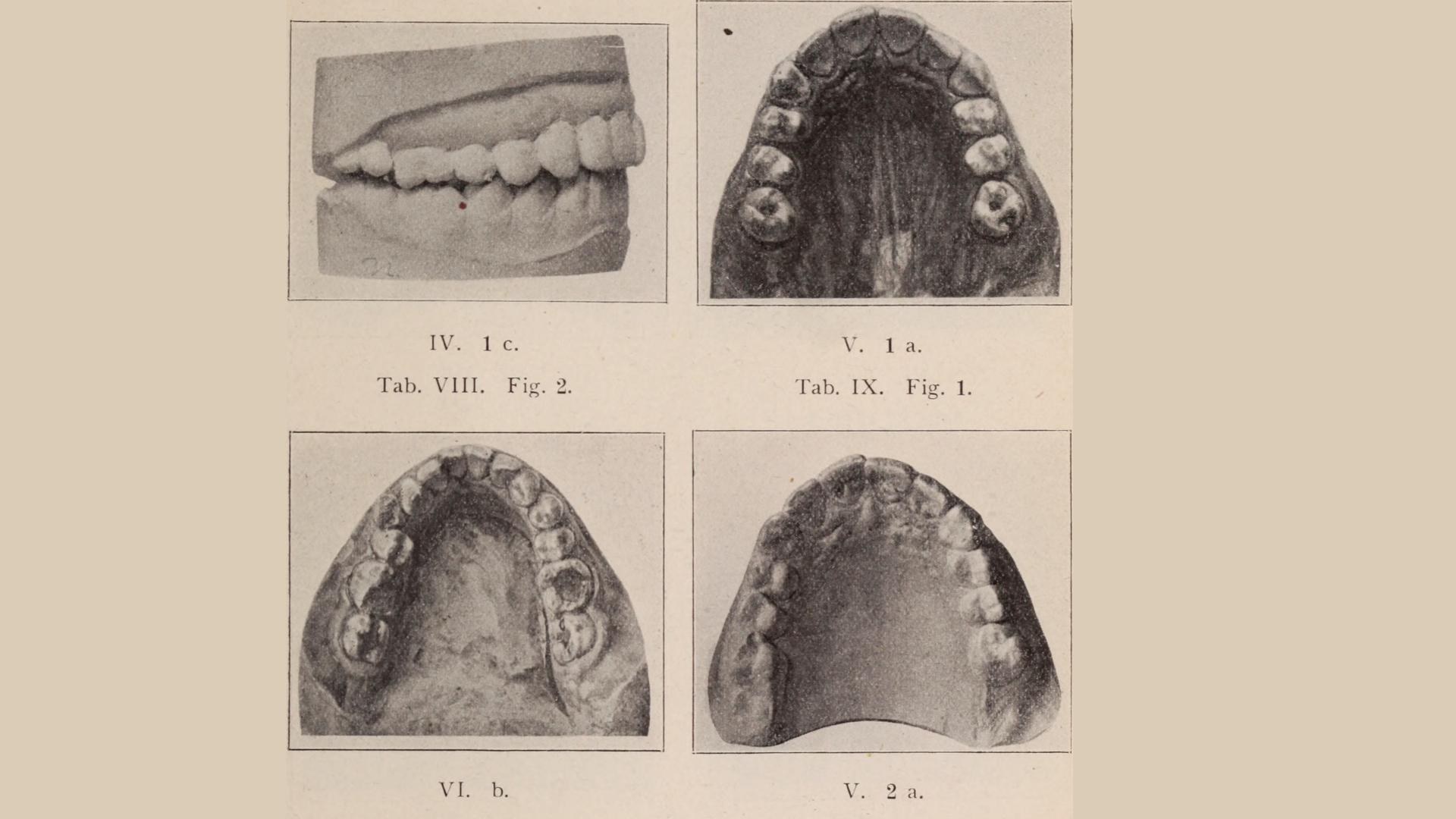 Facts about orthodontics